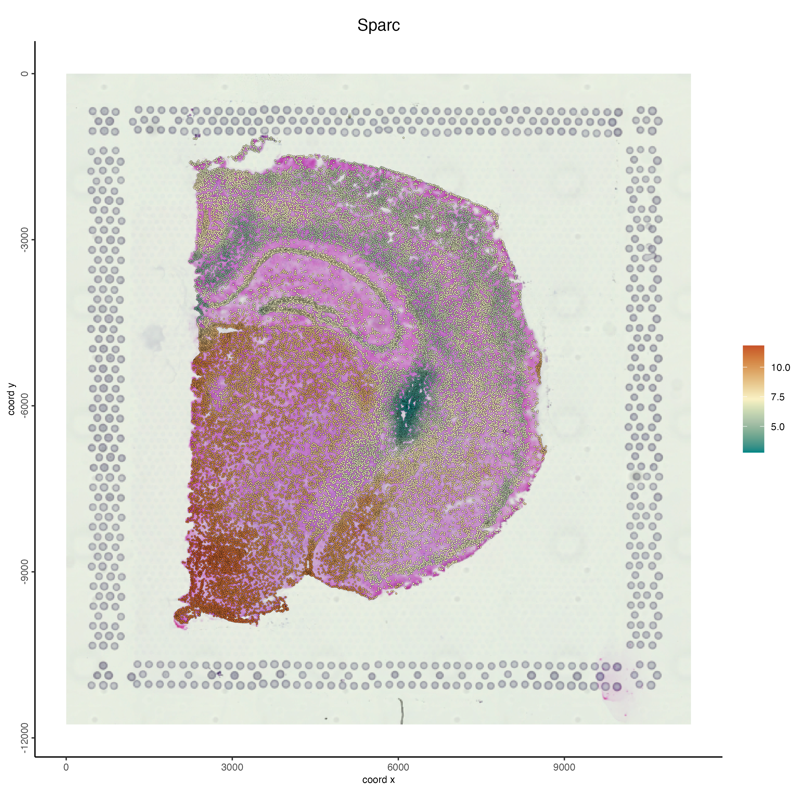 Gene expression for interpolated expression for Sparc