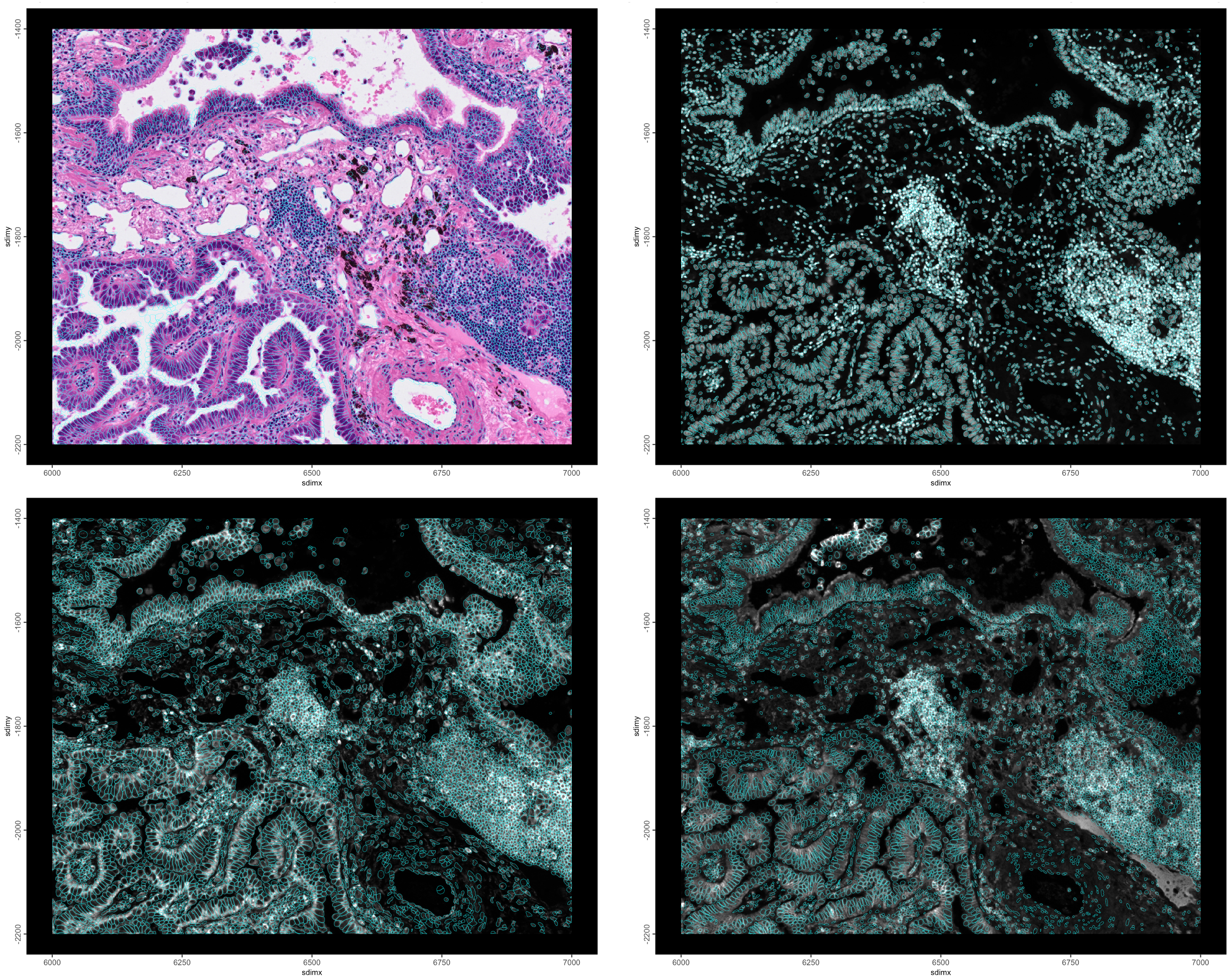 H&E and Cell polys (top left), DAPI and nuclear polys (top right), 18S and cell polys (lower left), ATP1A1/CD45/E-Cadherin and nuclear polys (lower right)