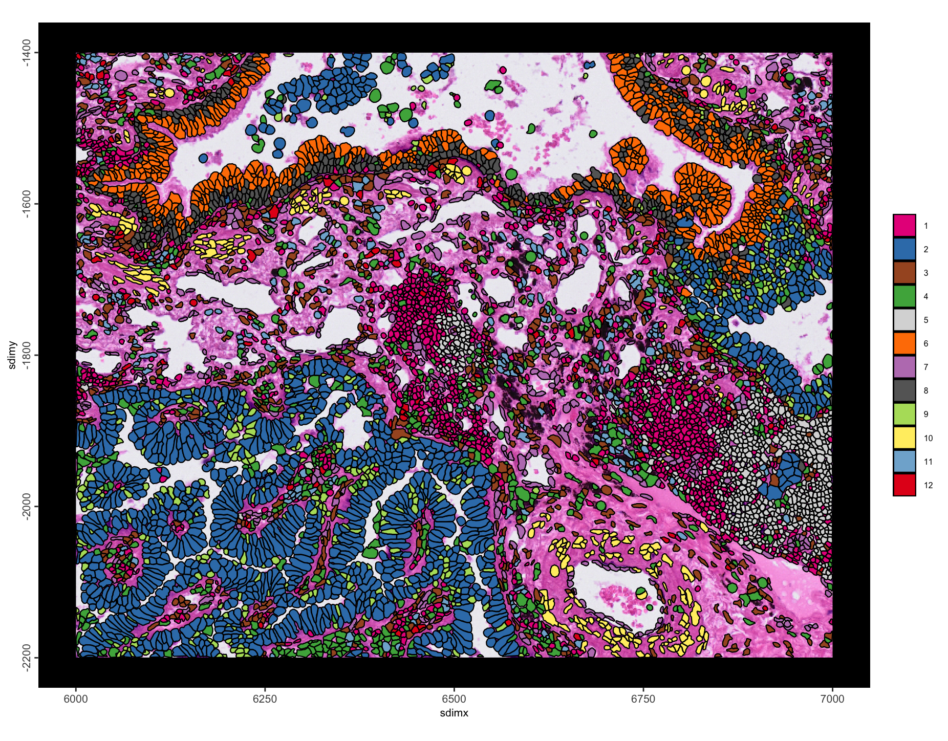 Spatial plot with leiden clustering annotations.