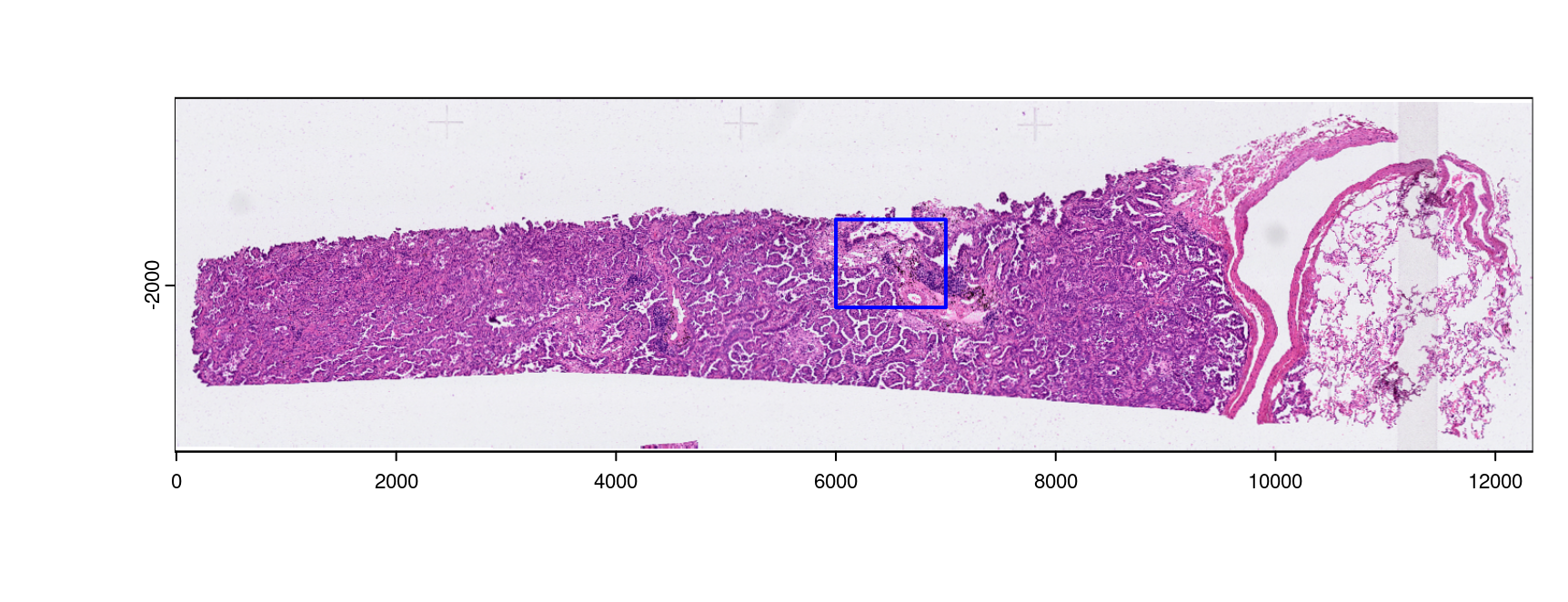 Shown is the H&E aligned to the Xenium dataset with micron scaling. The blue bounds mark out the area provided as a mini dataset