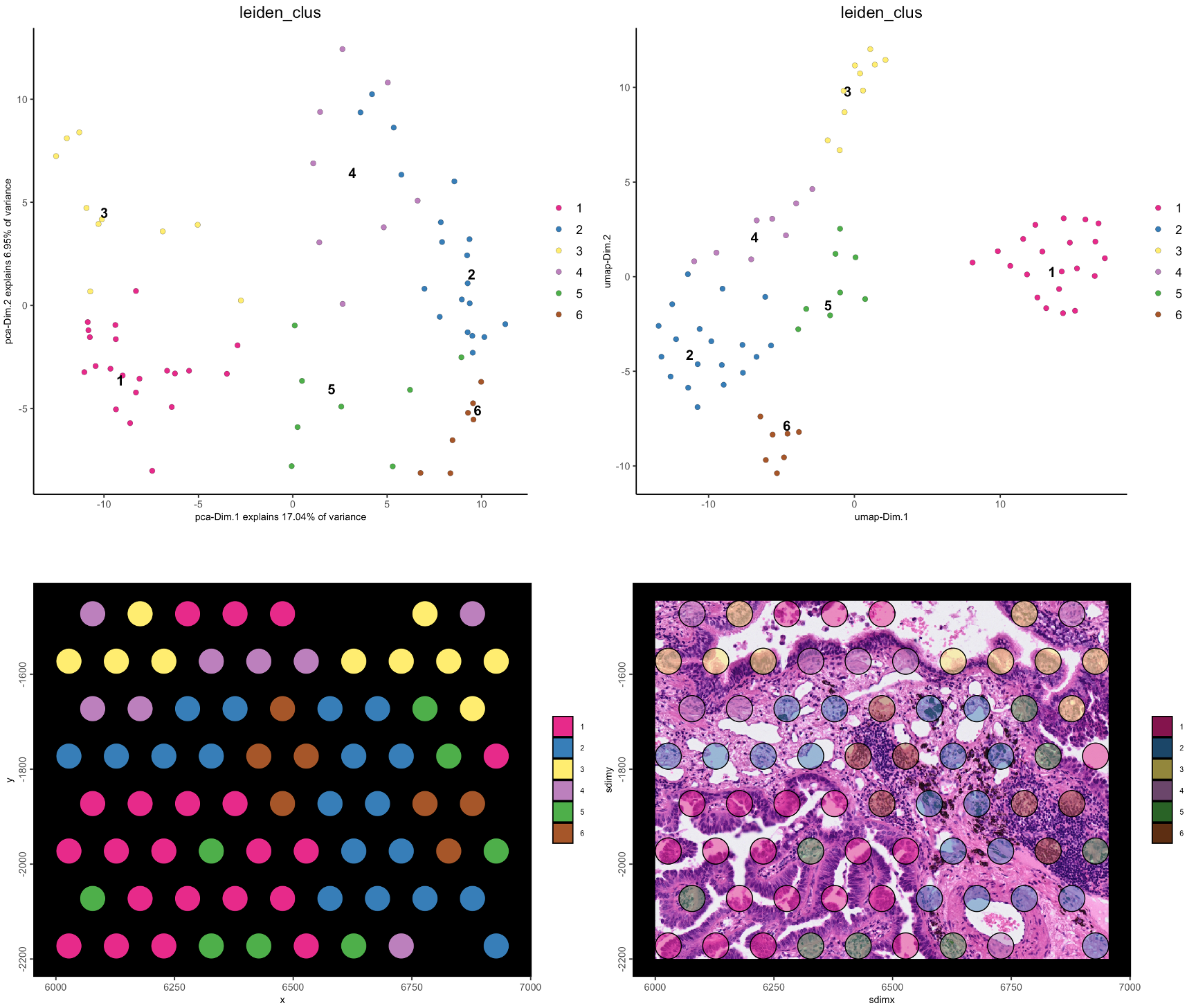 Leiden clustering in PCA (top left) and UMAP (top right) spaces, and in spatial plot with no image (bottom left), and with image (bottom right)