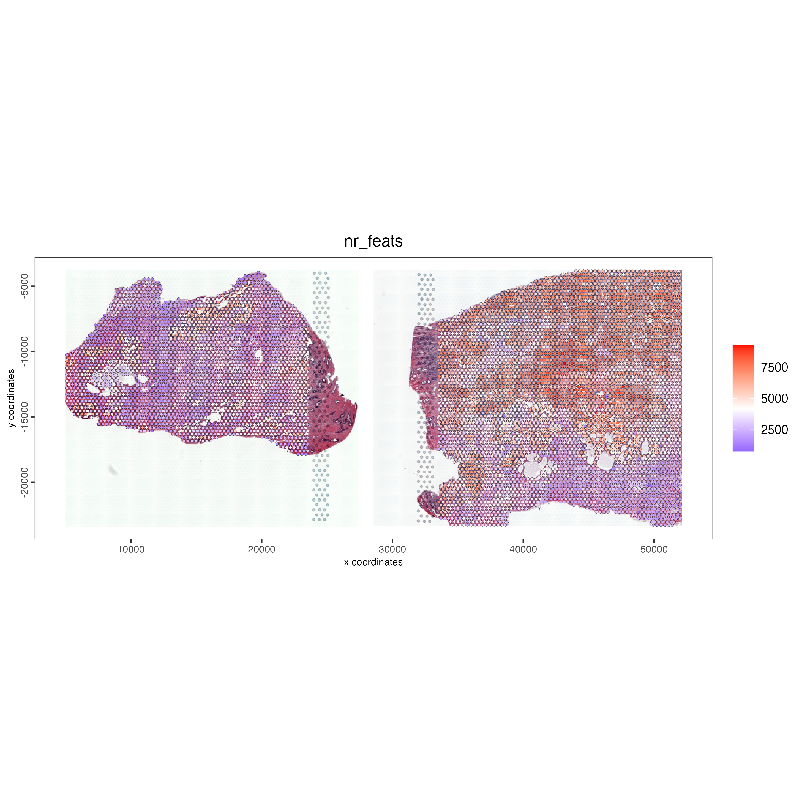 Unique feat expression for visium spots for both prostate samples.