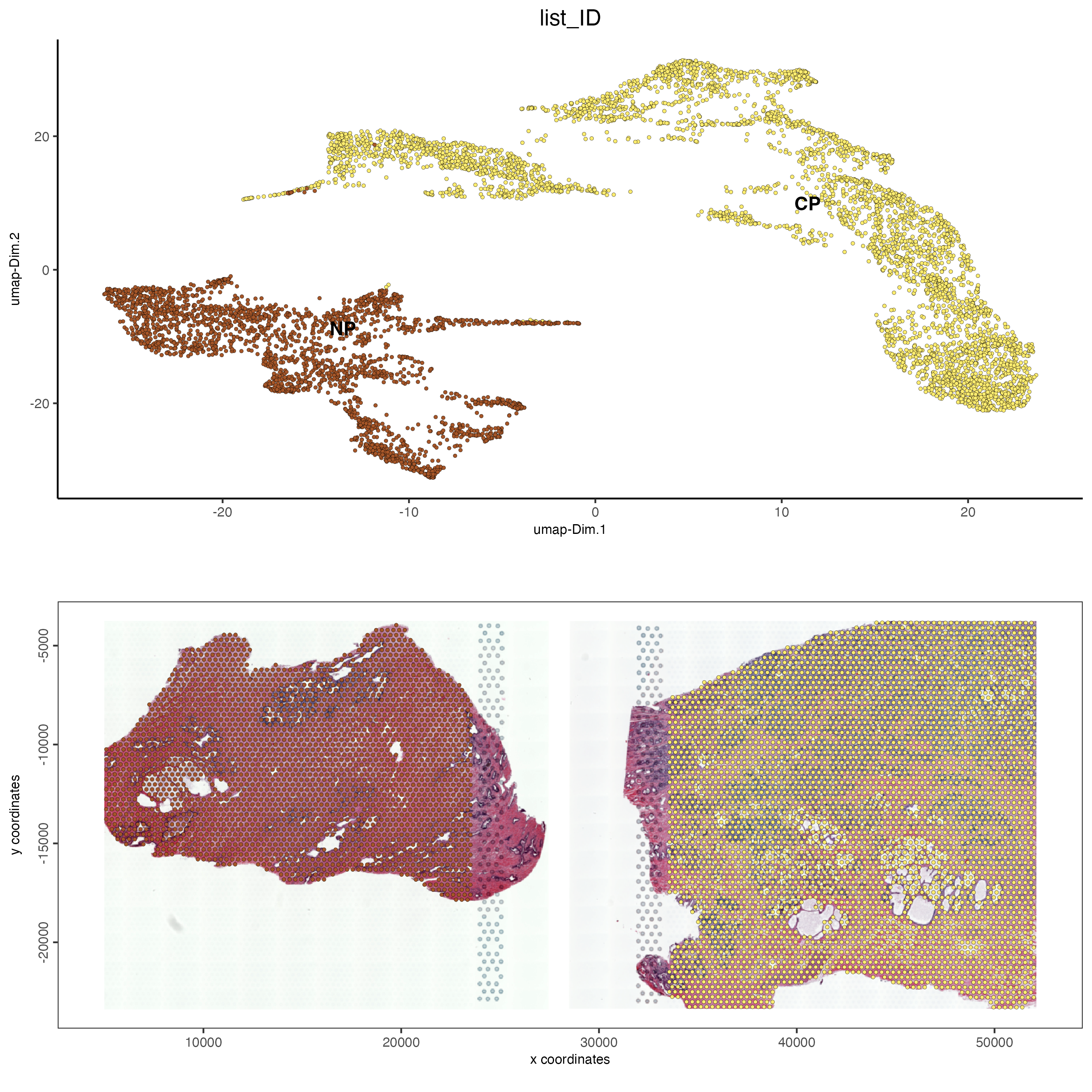 Tissue contribution for leiden clustering for the normal prostate (left) and the adenocarcinoma prostate sample (right).