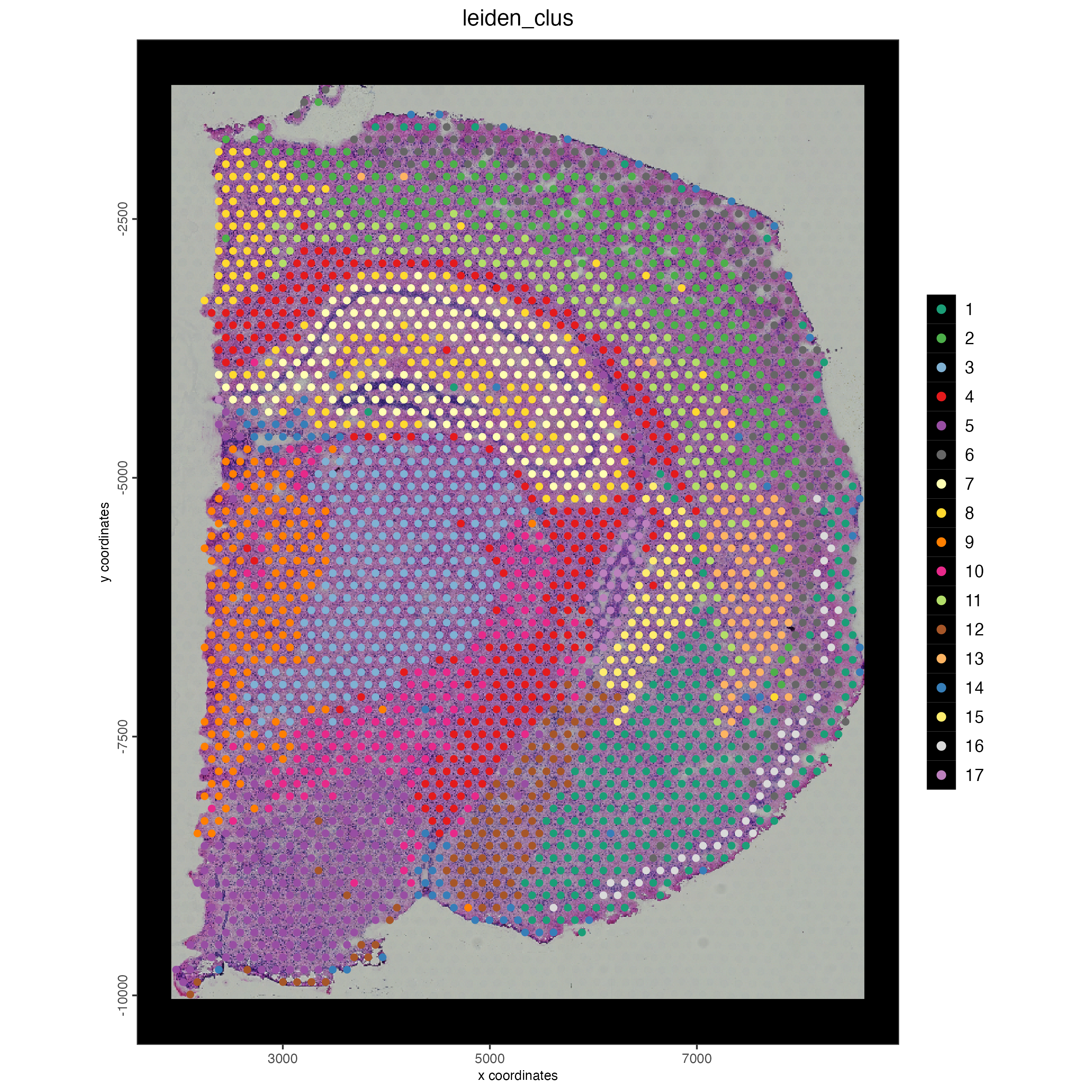 Mouse brain spatial plot showing leiden clustering